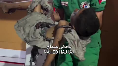 Three child martyrs have just arrived at Al Shifa Hospital (Graphic)
