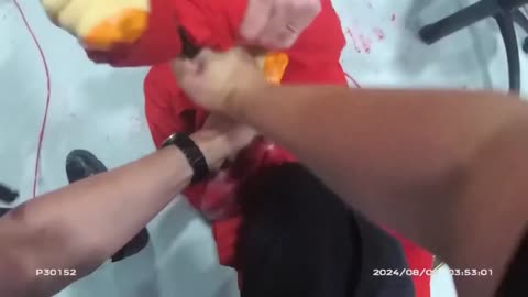 Police Struck With Sledge