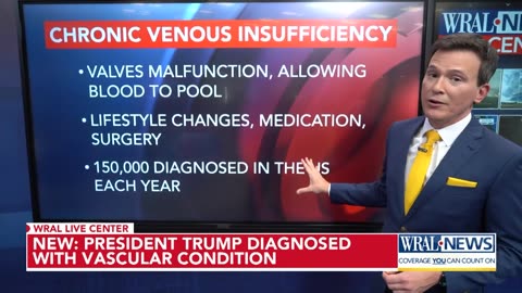 Trump is diagnosed with chronic venous insufficiency following leg swelling