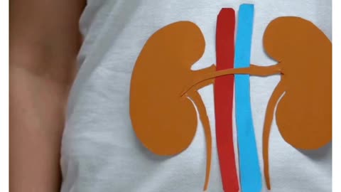 Kidney Stone Symptoms & Treatment | Madurai’s Leading Urology Experts