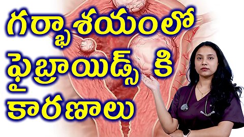 గర్భాశయంలో ఫైబ్రాయిడ్స్ కి కారణాలు Causes for Inferility due to Fibroids Homeopathy Treatment Cure