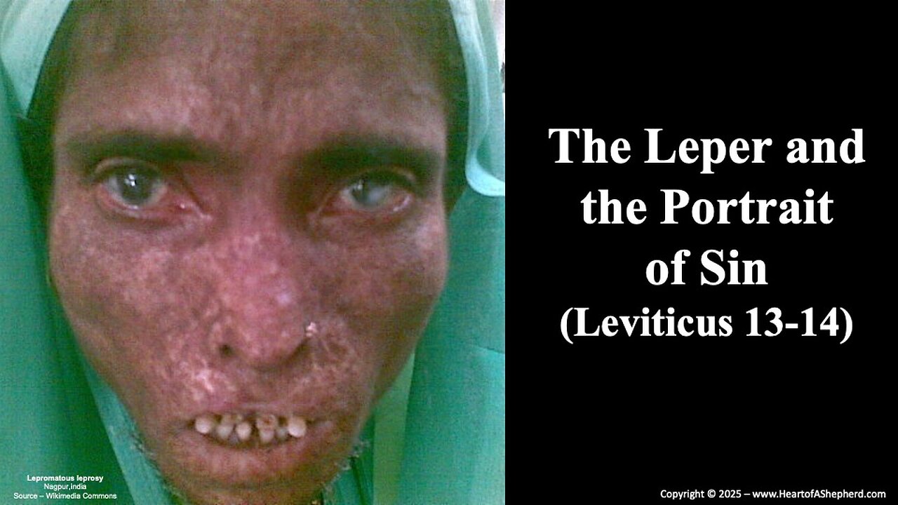 The Leper and the Portrait of Sin (Leviticus 13-14) Daily Bible study from www.HeartofAShepherd.com.