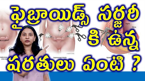 ఫైబ్రాయిడ్స్ సర్జరీ కి ఉన్న షరతులు ఏంటి? Who can Get Fibroids Surgery Removal Operation Myomectomy