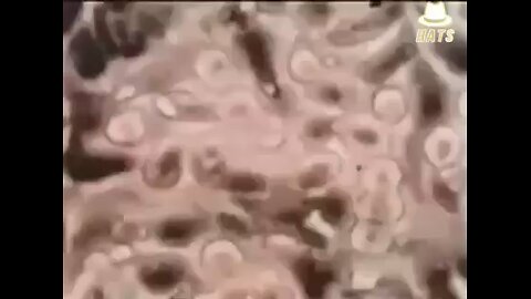Footage of flouride killing cells.