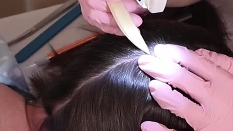 SnapTik Avatar SCALP Check Hairline Exam with Sensory Tests asmrmedicalroleplay asmrtiktoks e
