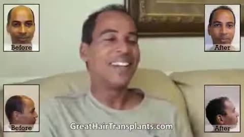 Another Happy Patient Thanks to Dr. Brett Bolton’s MaxHarvest™ Procedure