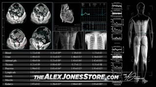 The Alex Jones Shows, LIVE !