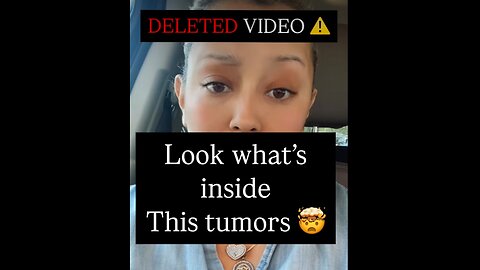 Colon Cancer Tumor- Really Filled With Parasites - graphic