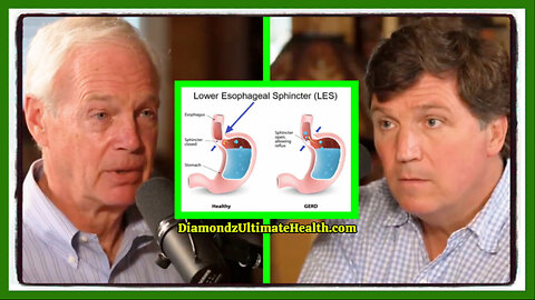 💦 HEALTH WATCH: Tucker Carlson’s Face Drops as Ron Johnson Reveals What Cured His Acid Reflux Disease