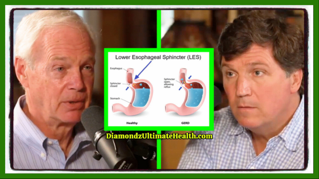💦 HEALTH WATCH: Tucker Carlson’s Face Drops as Ron Johnson Reveals What Cured His Acid Reflux Disease ☆ Links Included Below