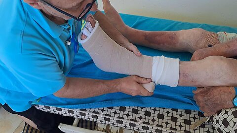 Bendaggio linfologico compressivo