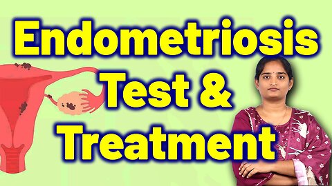 Endometriosis Tests & Best Treatment | Infertility Uterine lining Homeopathy, Medicine Cure Surgery