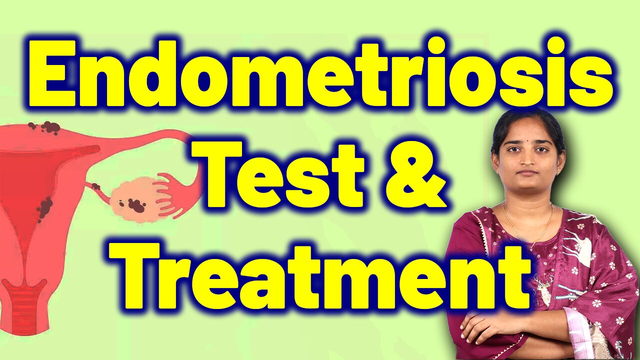 Endometriosis Tests & Best Treatment | Infertility Uterine lining Homeopathy, Medicine Cure Surgery