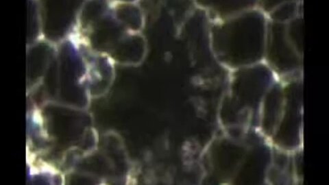 "Analyzing Live Blood with Novex B"