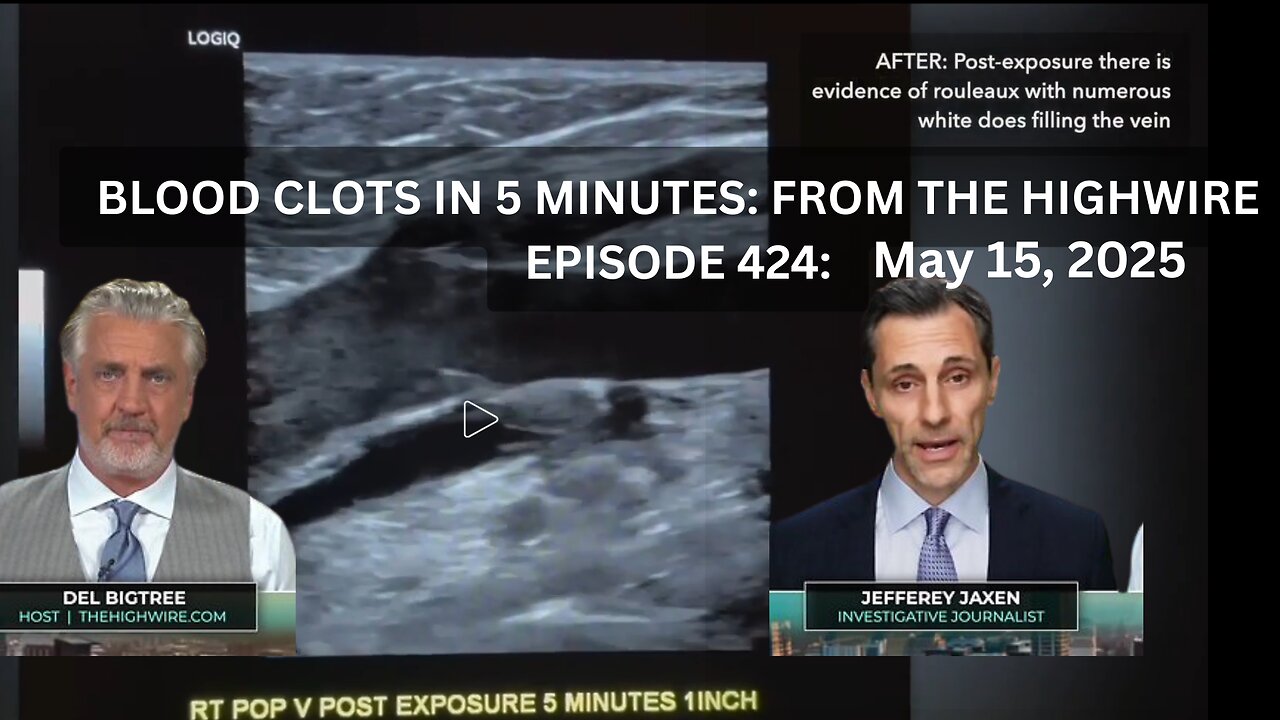 BLOOD CLOTS IN 5 MINUTES: FROM THE HIGHWIRE EPISODE 424 - May 15, 2025