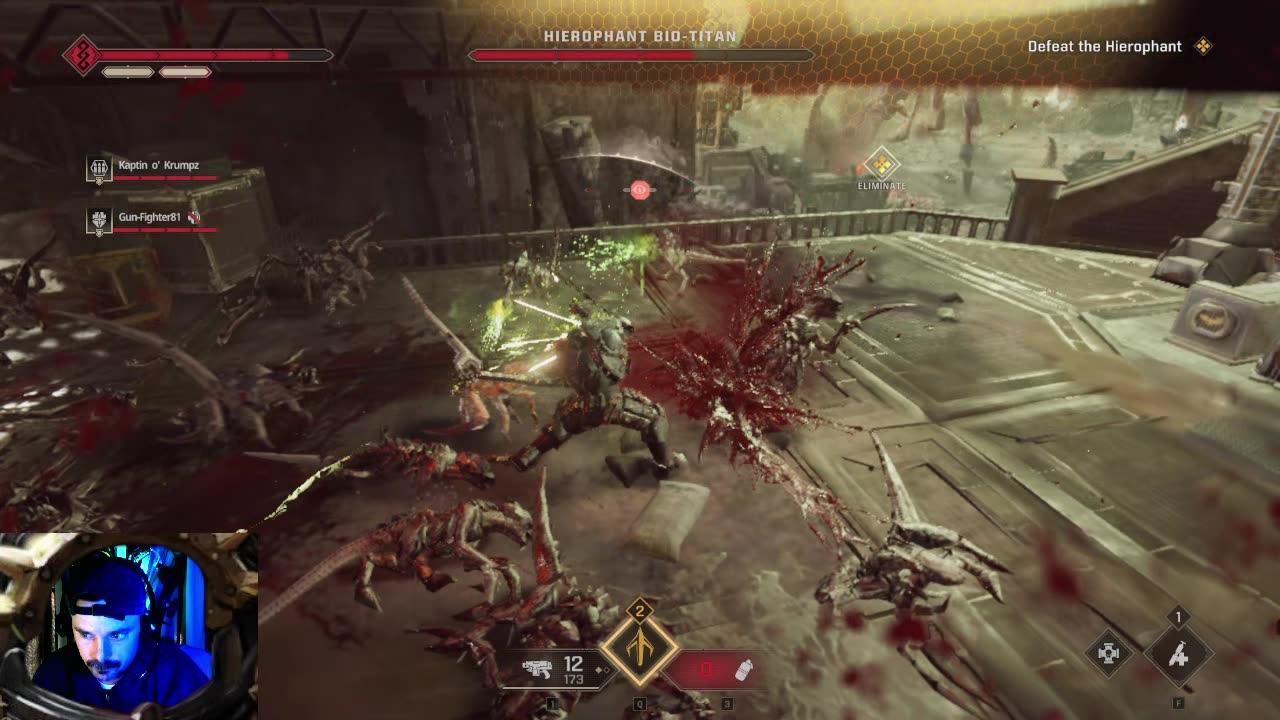 🔴 Best Siege yet !