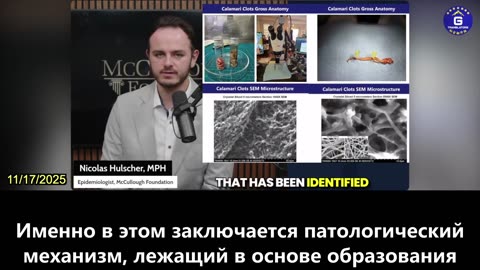 【RU】У всех, кто получил вакцину от КОВИД-19, в крови обнаружены амилоидные микросгустки