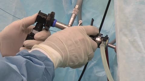 Laparoscopic Urology Care in Madurai