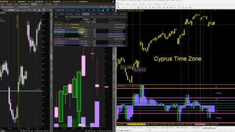 Basics Of Setting Up An Options Trade