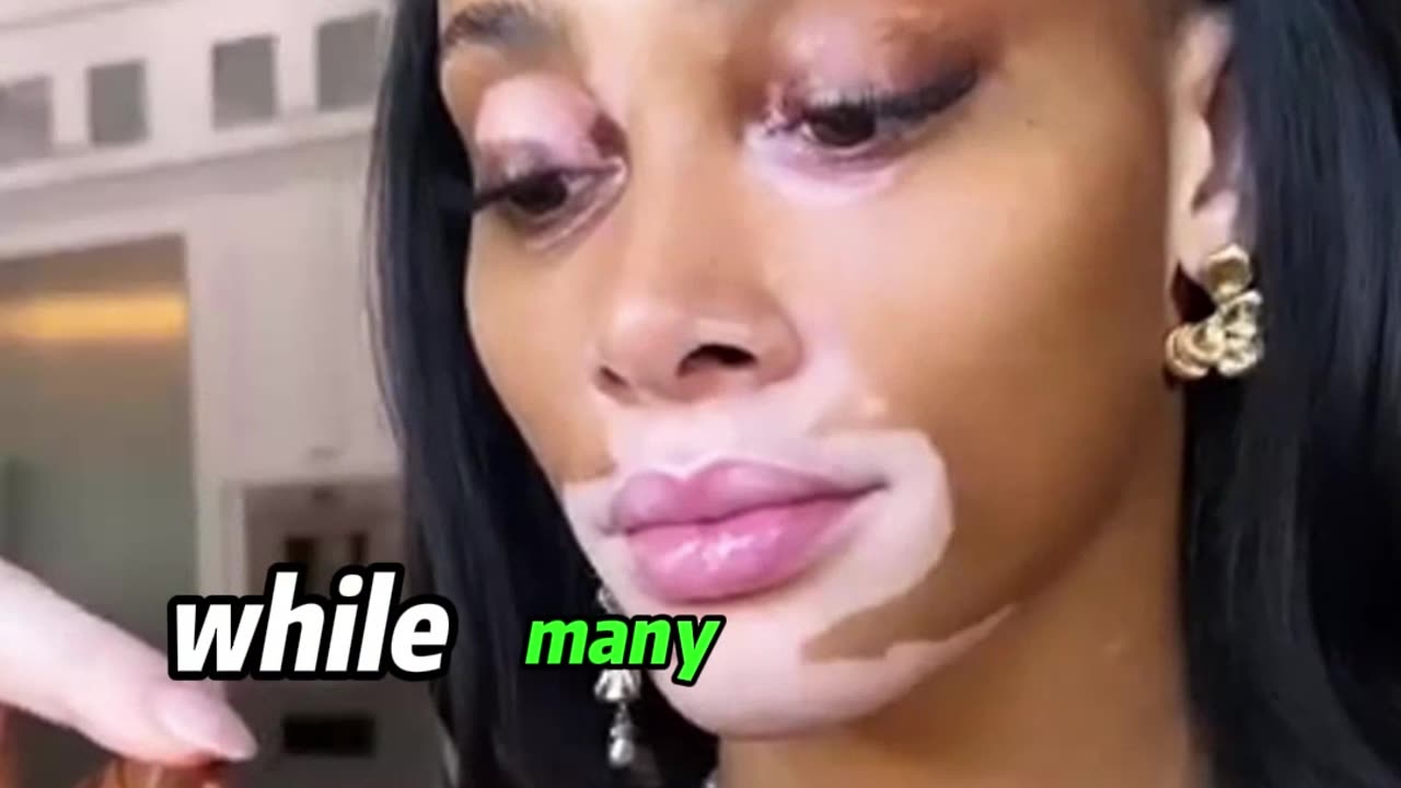 Why Winnie Harlow Is So Loyal to Kyle Kuzma (3 Powerful Reasons!)