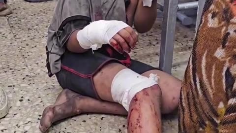 Her wounds tell the story of Ga_za’s children innocent lives shattered by genoci de