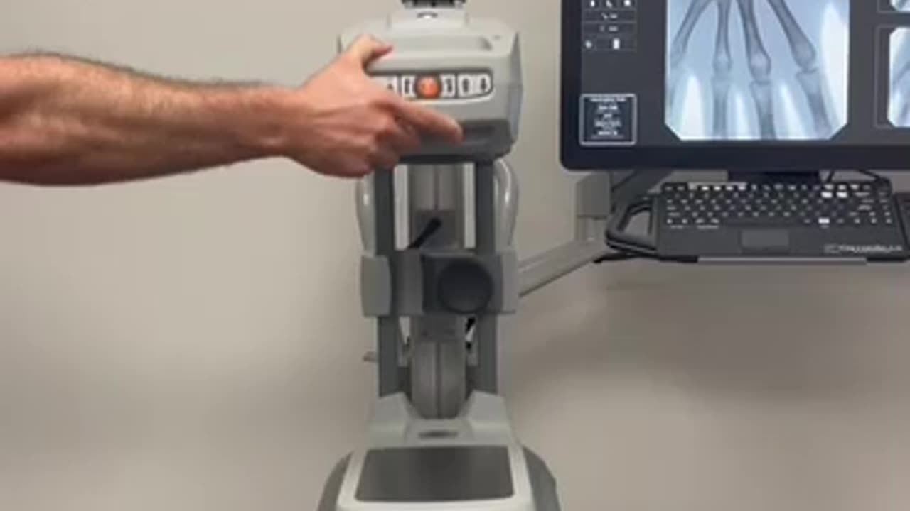 Orthoscan MDI | Orthoscan Mobile DI Mini C-Arm | Short Overview from Minicarm.com
