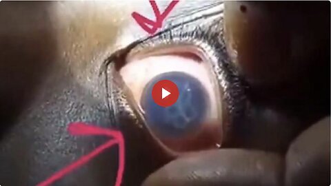 FREAK OUT ALERT - Dr. records Hydra Vulgaris swimming in the eye of an 11yr old vaxxed patient