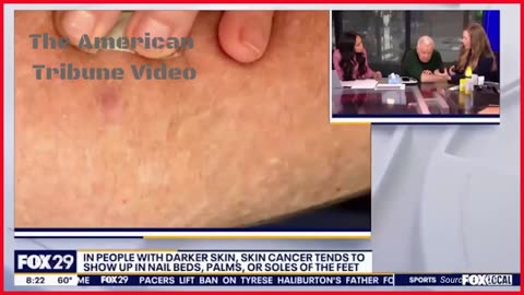 WATCH: Fox News Anchor Discovers He Has Cancer Live on Air During Broadcast