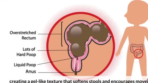 15 Foods That Help You Poop Naturally Without Laxatives