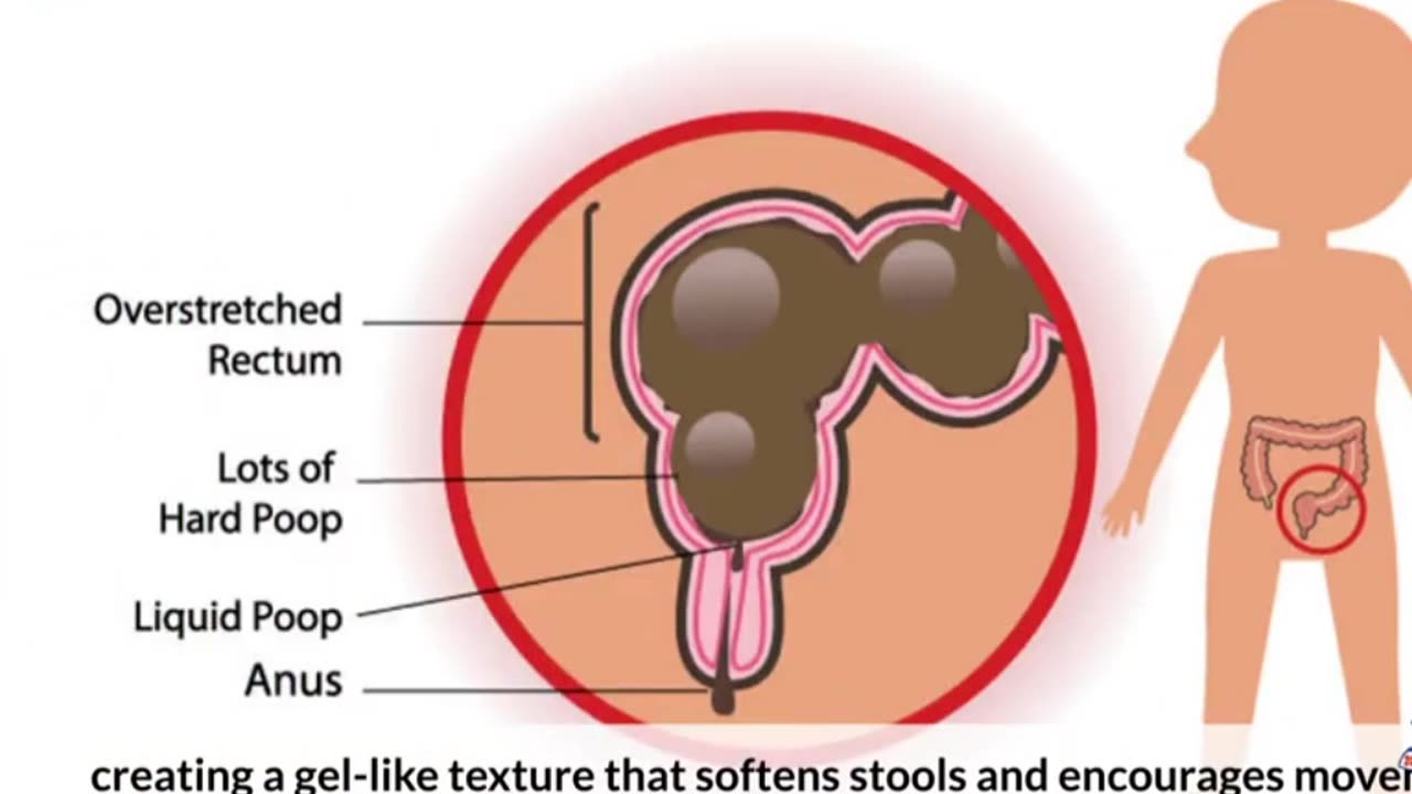 15 Foods That Help You Poop Naturally Without Laxatives
