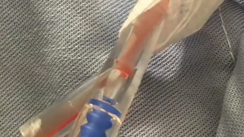 Bone Marrow Transplant Surgery 🩸 Life-Saving Medical Procedure Explained