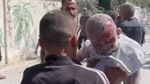 A Palestinian infant was critically injured in an Israeli airstrike