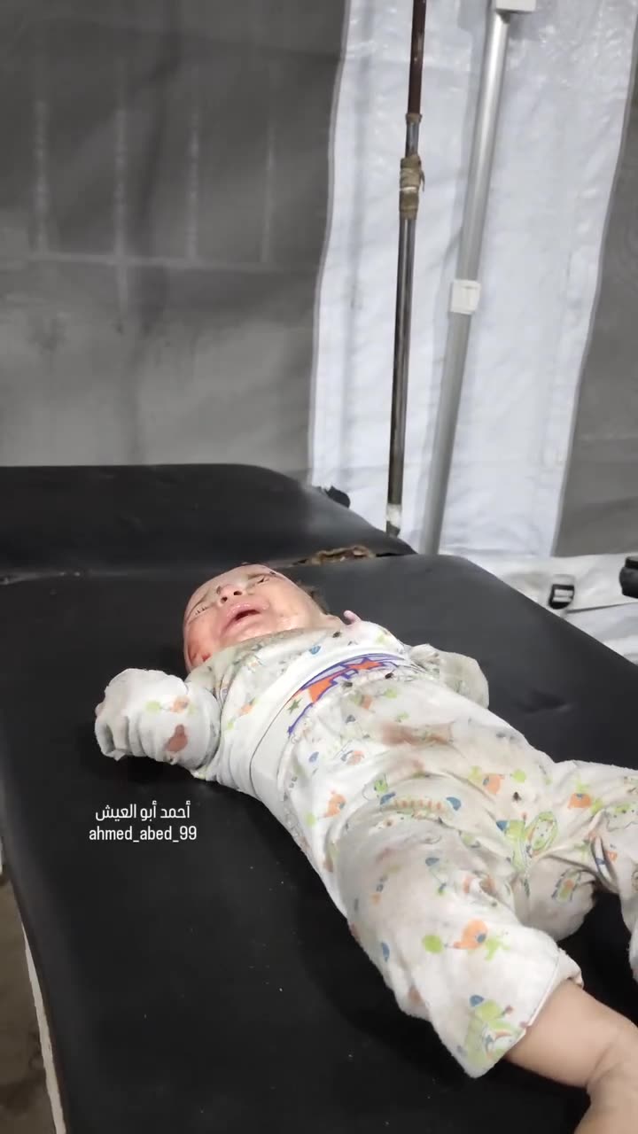 A Palestinian infant cries in pain after being injured in tonight’s Israeli bombardment