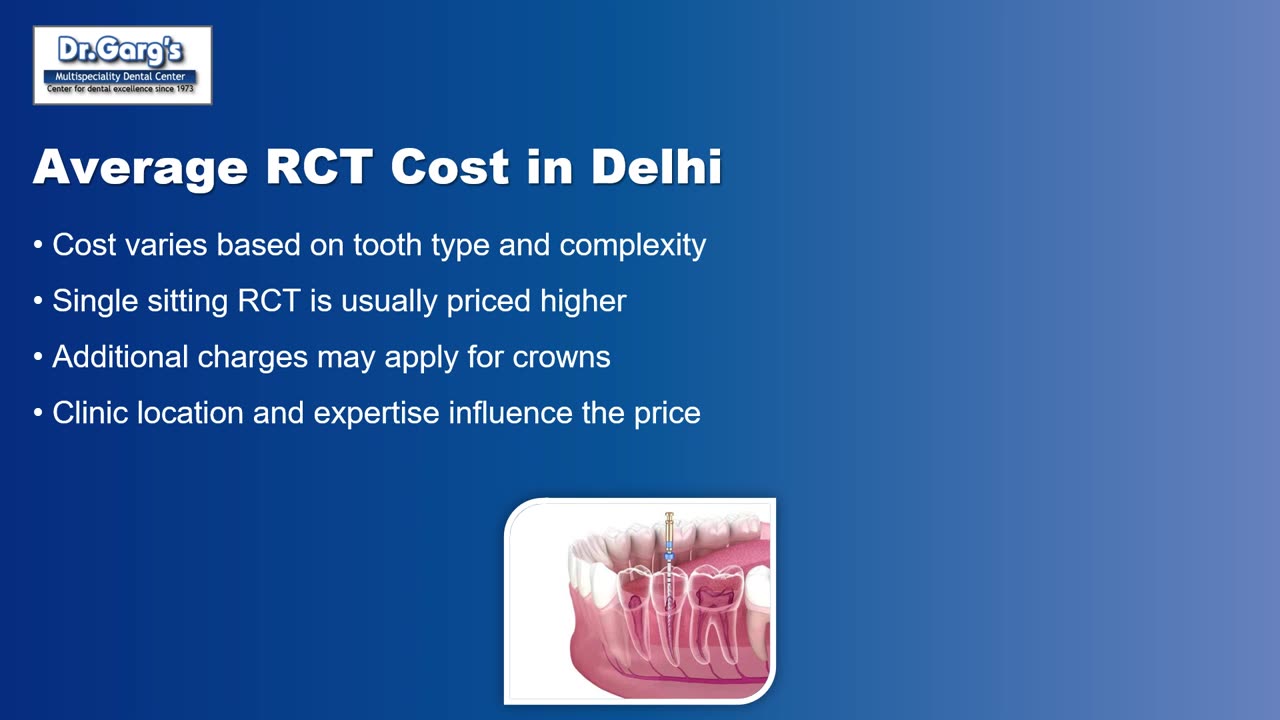 Root Canal Treatment Cost in Delhi Explained by Dr. Garg’s Multispeciality Dental Center