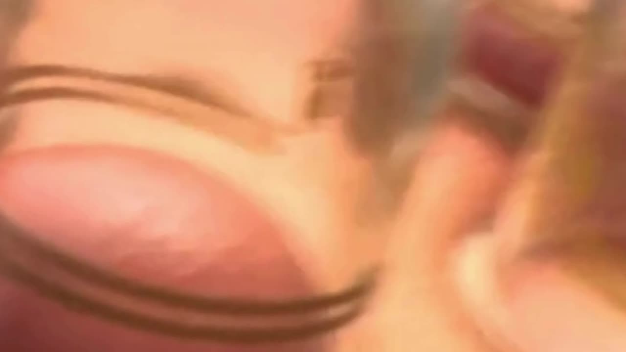 Cupping Therapy Explained – Sri Sai Physiotherapy Clinic