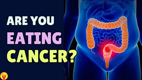 11 WORST Foods That Feed CANCER Cells (You're Eating Cancer!) | VJ11