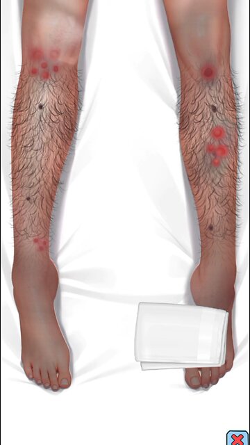 Discover the Secrets of Effective leg hair Solution #shorts