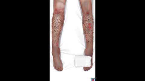 Discover the Secrets of Effective leg hair Solution #shorts