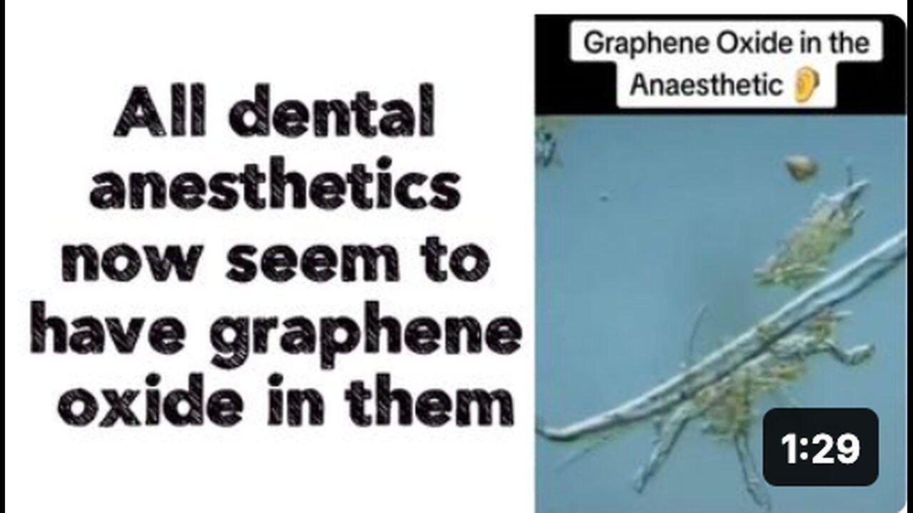 "Graphene Oxide Now Appears in All Dental Anesthetics"