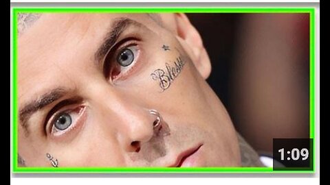 "Rock Star Hospitalized for a Week Following Vaccination Reactions"