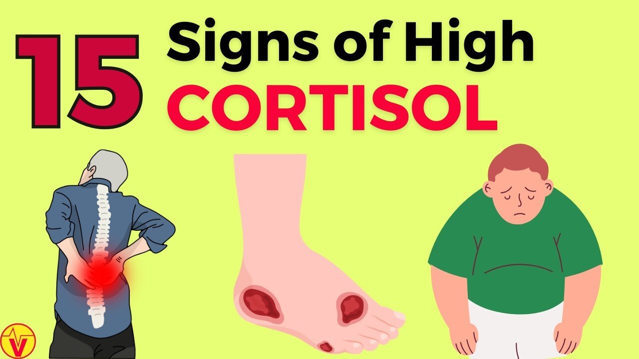 Are You Overloaded? Unmask 15 Telltale Signs of High Cortisol Levels! VJ36