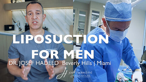 Liposuction for Men | Achieve a Sculpted, Athletic Look