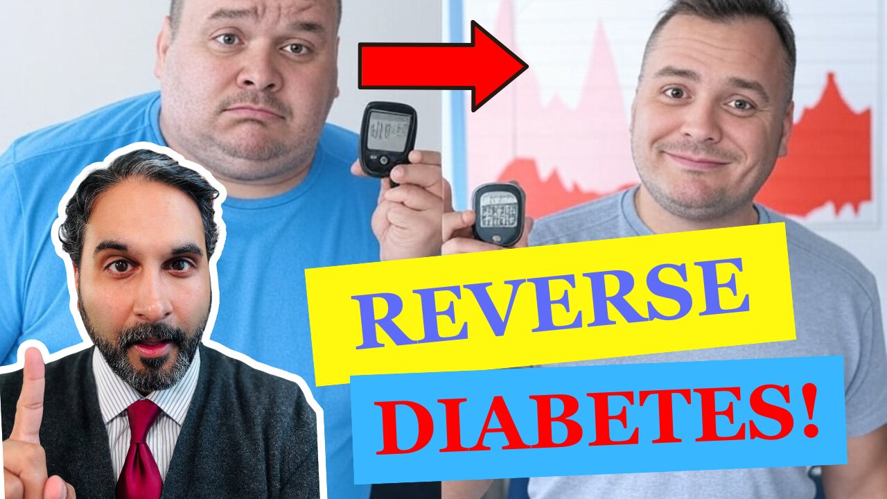 This Study REVERSED Diabetes in 79% of Patients
