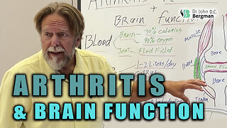 Arthritis Reversal & Brain Function 🦴🧠