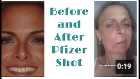 "Pre and Post Pfizer Vaccination"