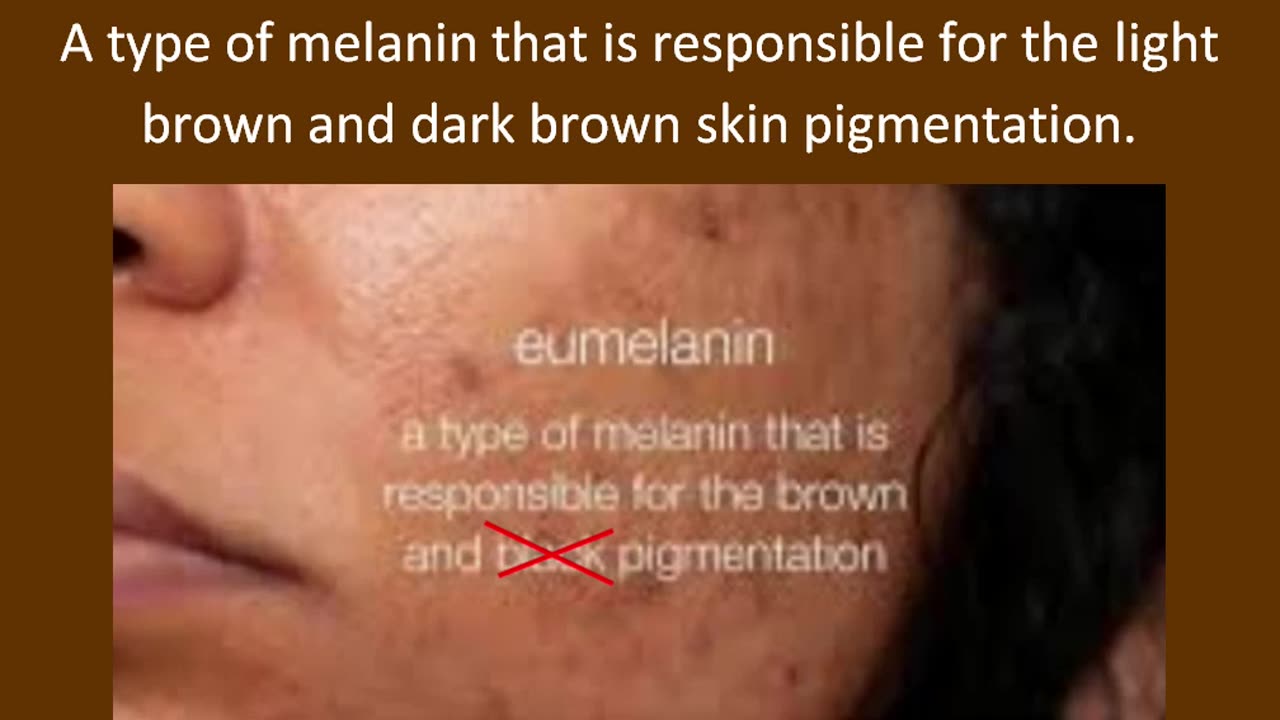 There is no such thing in genetics as a black skin pigment