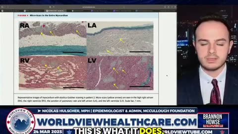 Permanent damage is caused by the spike protein in the mRNA shots.
