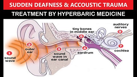 Deafness by Hyperbaric Medical Therapy