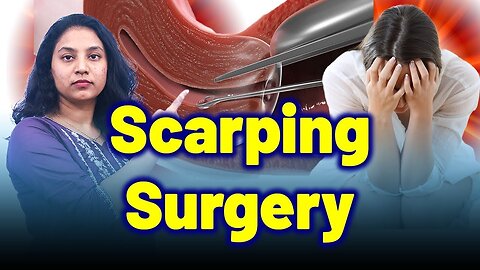 Can Uterus Be Treated Without Scraping Surgery? | Treatment & Cure | Homeopathy, Medicine