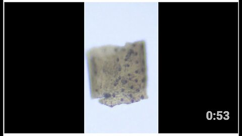 "Unjabbed Individual Discovers Hydrogel Bio Weapon Emanating from Skin Due to Nanotechnology"